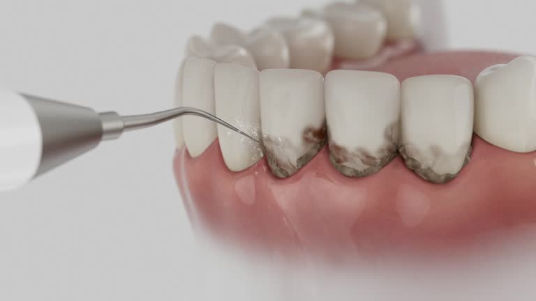 Reliable Dental Implants contractor in Derby, CT by Smile Center Dentistry